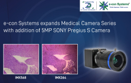 e-con Systems expands Medical Camera Series with addition of 5MP SONY Pregius S Camera