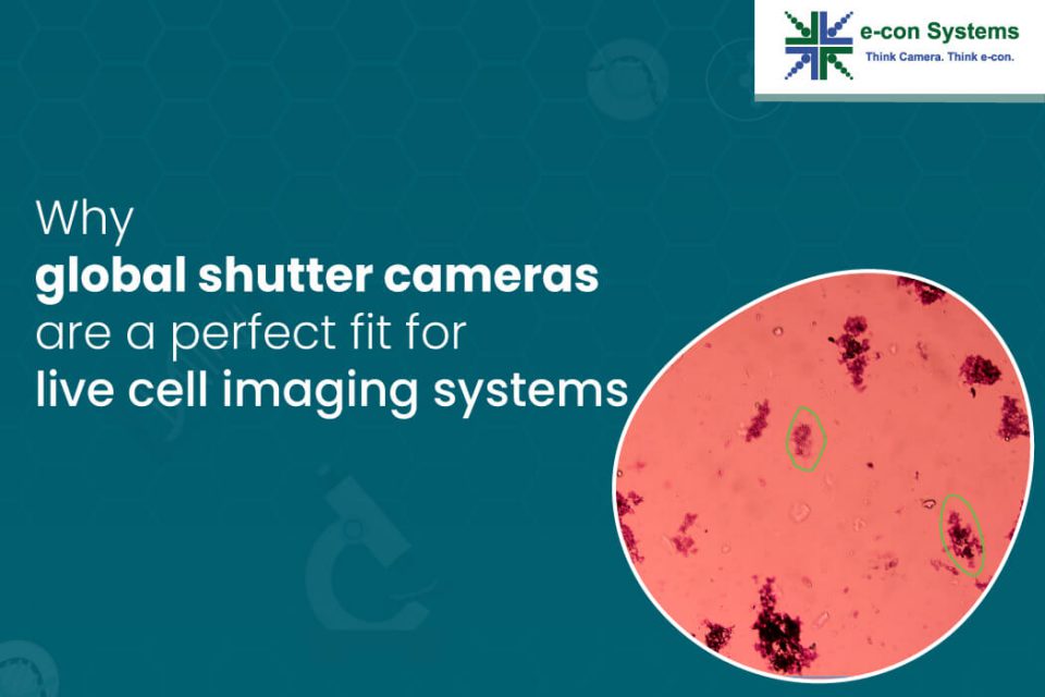 Why global shutter cameras are a perfect fit for live cell imaging systems