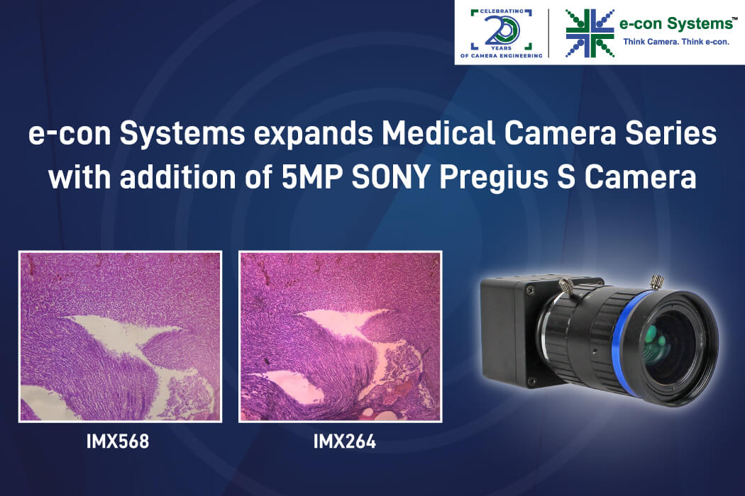 e-con Systems expands Medical Camera Series with addition of 5MP SONY Pregius S Camera