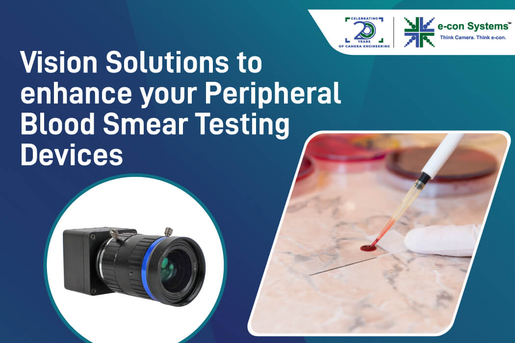 Vision Solutions to enhance your Peripheral Blood Smear Testing Devices