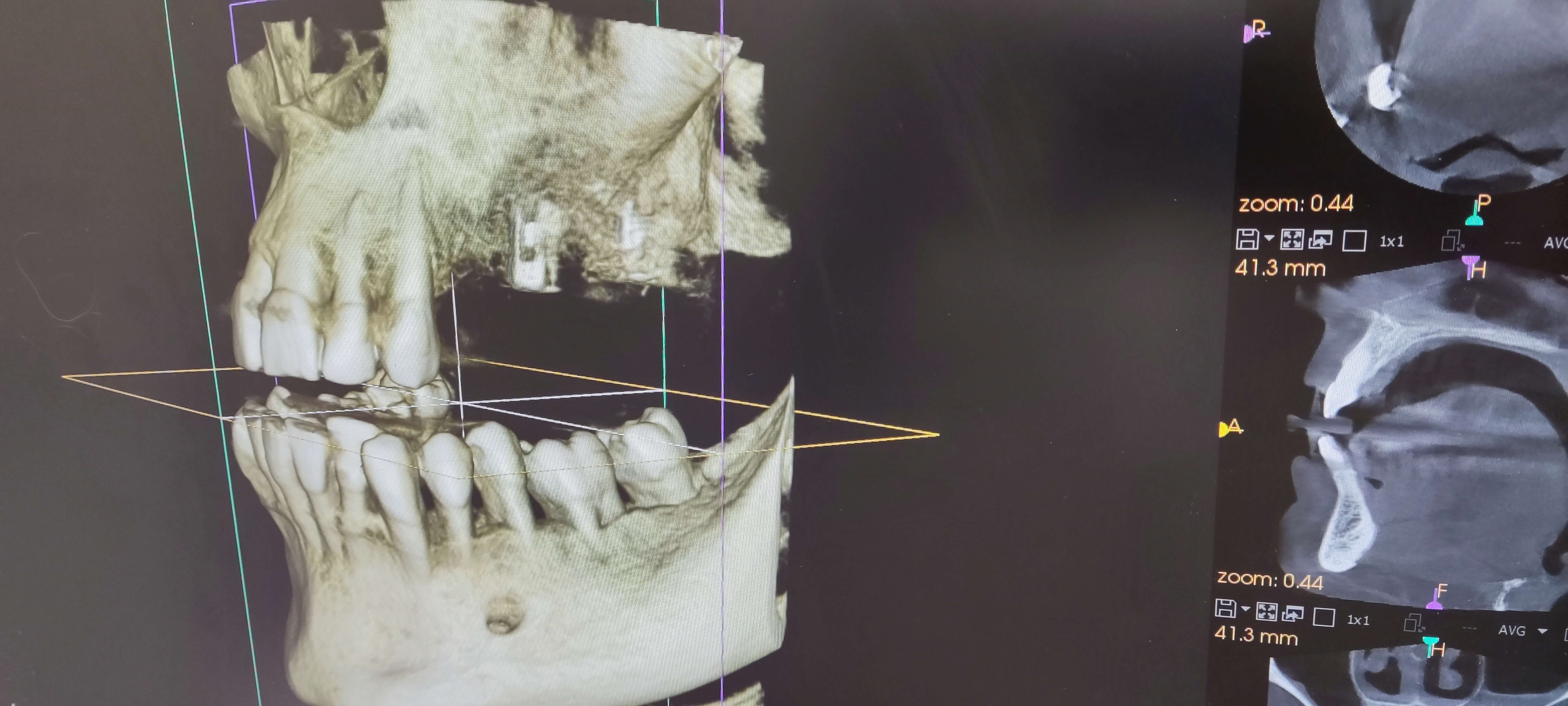 Cone Beam Computed Tomography