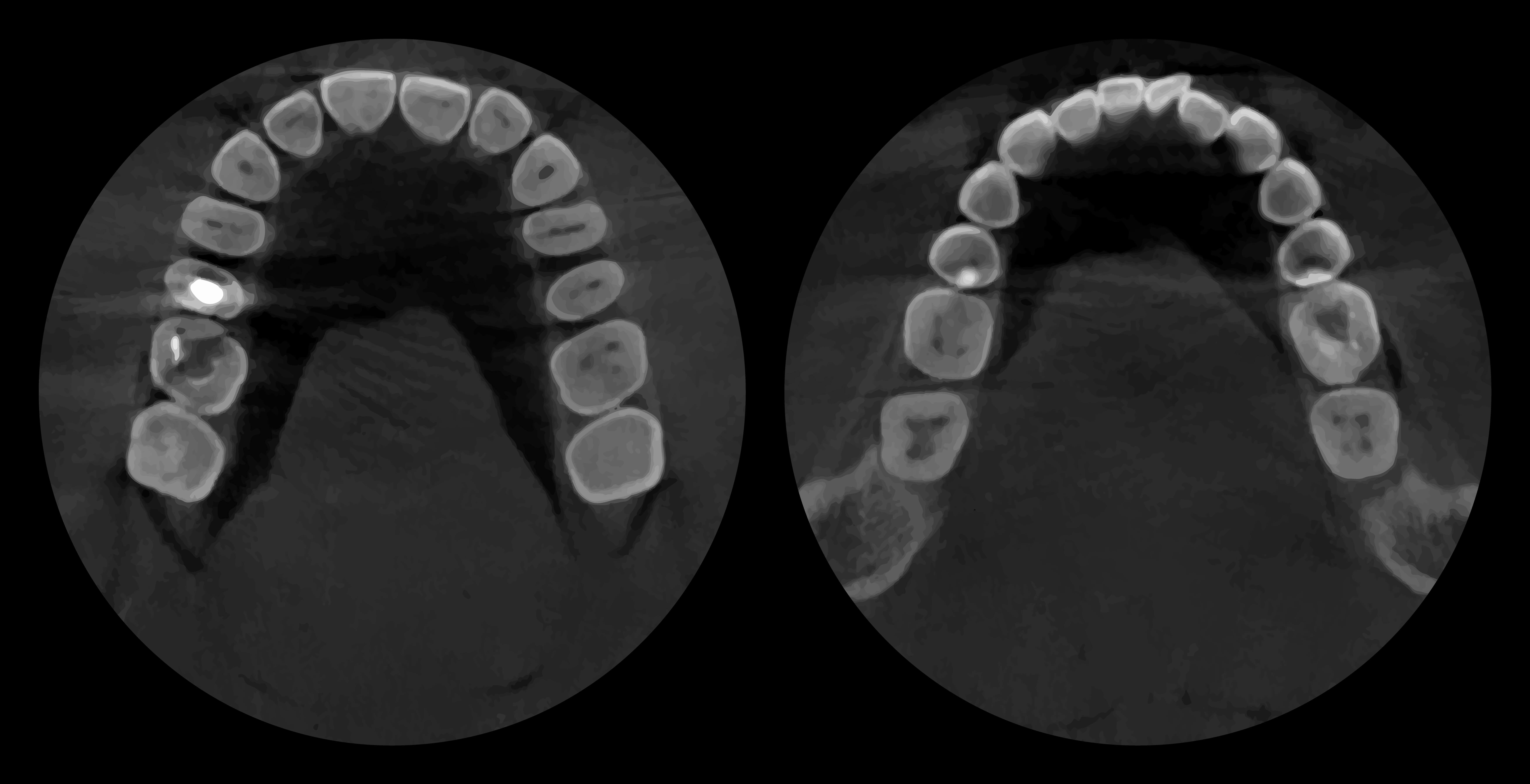 Magnetic Resonance Imaging