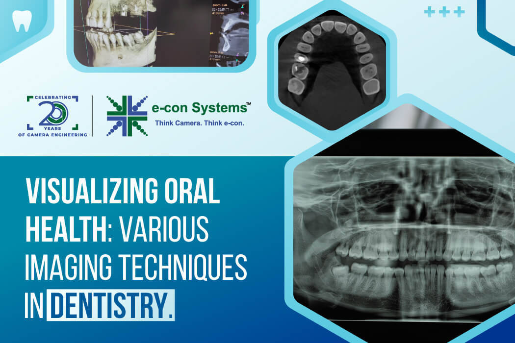 Visualizing Oral Health