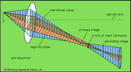 Astigmatism