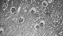 Lungs - Trachea H&E stain sample image using See3CAM_50CUGM