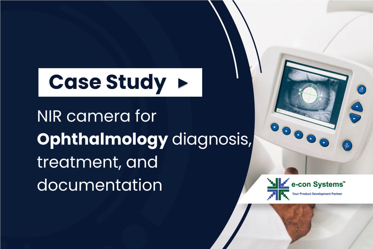 Ophthalmology Cameras Case Study
