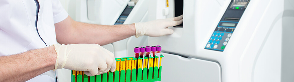 Automated Laboratory Analyser Case Study banner